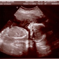 baby-Lichty